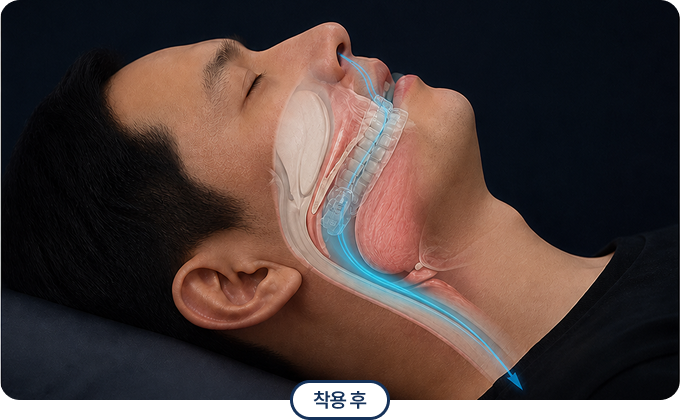 착용 gn
