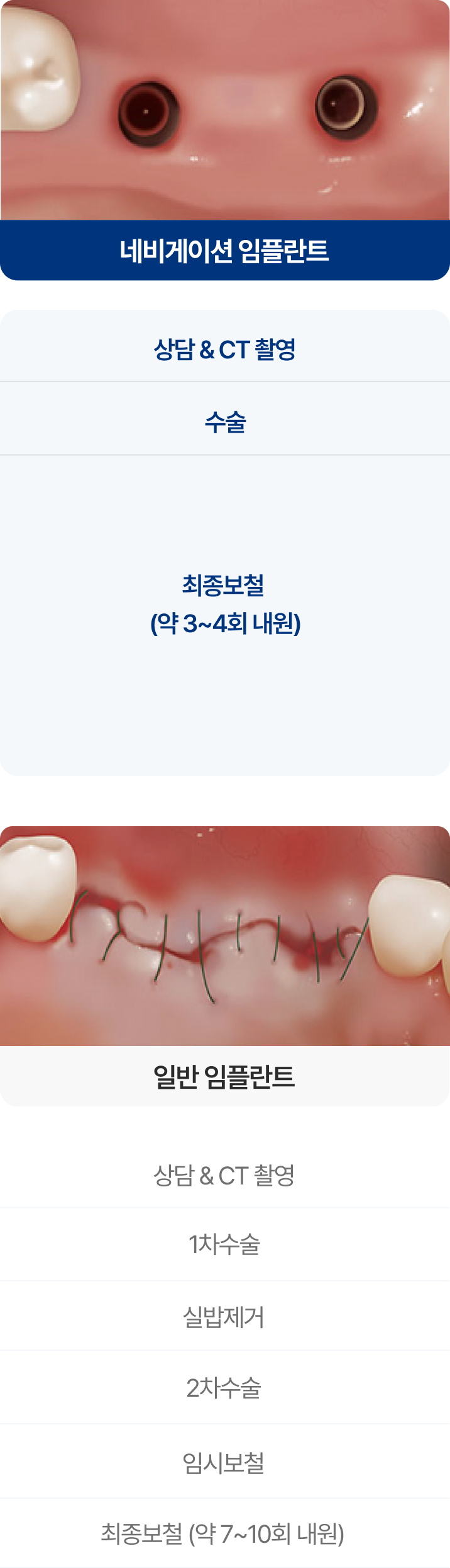 네비게이션, 일반 임플란트의 차이