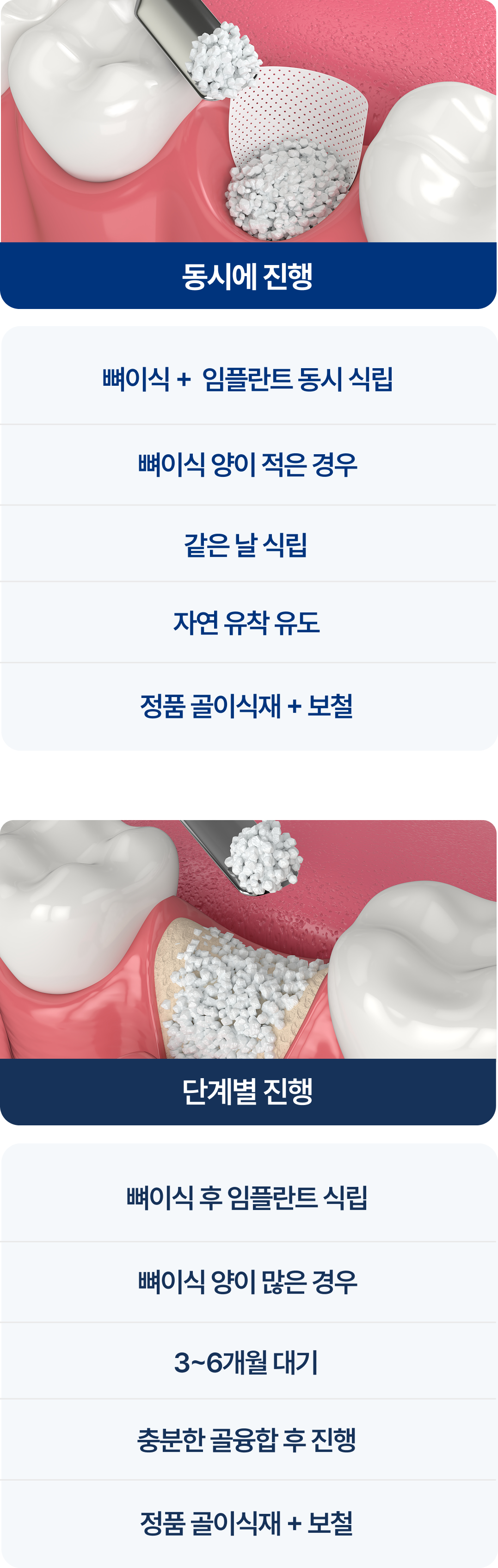 동시, 단계별 진행에 따른 뼈이식 임플란트의 차이점